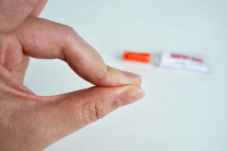 Super Attack sulle dita? Niente panico! Ecco come rimuovere la colla con un trucco infallibile modi per eliminare attack dalle dita